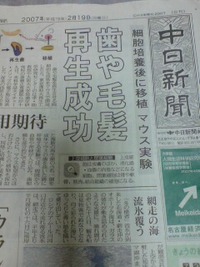 第2永久歯