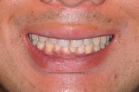�