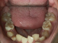 �
