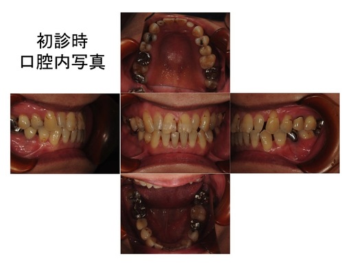 �