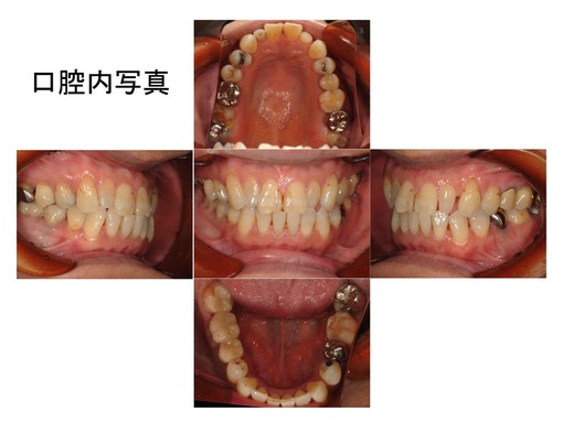 �
