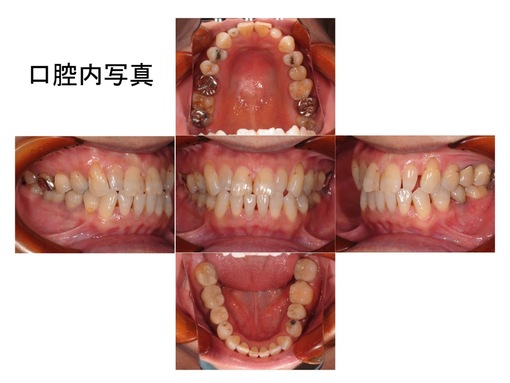 �