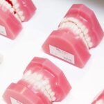 インプラント症例紹介