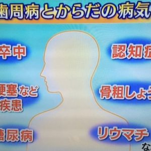 歯周病から全身疾患にのイメージ