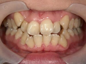 矯正治療・セラミック治療・ホワイトニングのイメージ