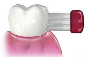 歯の磨き方のイメージ