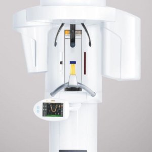 CTレントゲンのイメージ