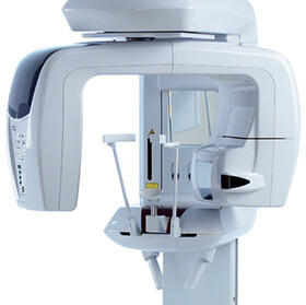 パノラマ・デンタルレントゲンのイメージ