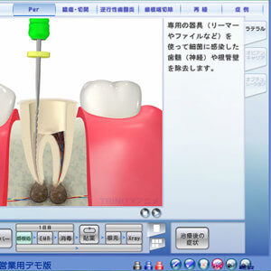 患者様説明用アニメーション・画像管理ソフトのイメージ