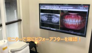 鈴鹿市の歯医者「大木歯科医院」の院長ブログ-お口の中を常にビジュアル化しています！のイメージ
