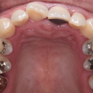 機能性を重視した審美歯科治療例のイメージ