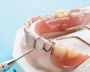 奥歯でも入れ歯を入れられる？奥歯の入れ歯について解説のイメージ