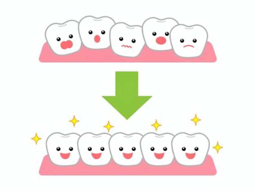 歯並びに舌と唇が影響する？！のイメージ