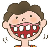 すきっ歯は矯正治療が必要？すきっ歯の治療方法をご紹介のイメージ