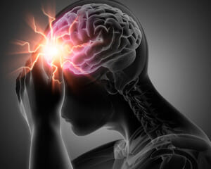 インプラント治療後に頭が痛い？考えられる原因と対処法について解説のイメージ