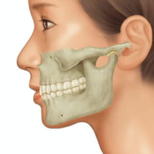 鈴鹿市の歯医者「大木歯科医院」の管理栄養士ブログ-マスク生活で顎が痛い！コロナウイルスは顎関節症を引き起こす？のイメージ