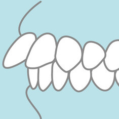 出っ歯の矯正をしたほうがいい3つの理由のイメージ