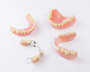 入れ歯の様々な種類と特徴のイメージ