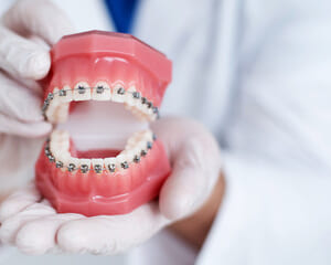 歯科矯正治療の全て：理解と選択のガイドのイメージ