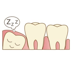 親知らずが生えたらどうするの？のイメージ
