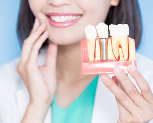鈴鹿市の歯医者「大木歯科医院」の歯科ブログ-インプラント治療と治療後のトラブル・予防についてのイメージ