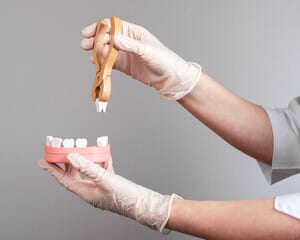 矯正治療で抜歯する歯はどの歯ですか？のイメージ