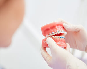 鈴鹿市の歯医者「大木歯科医院」の歯科ブログ-マウスピース矯正とワイヤー矯正の違いとメリット・デメリットとは？のイメージ